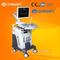 China medical ultrasound equipment & sonography machine